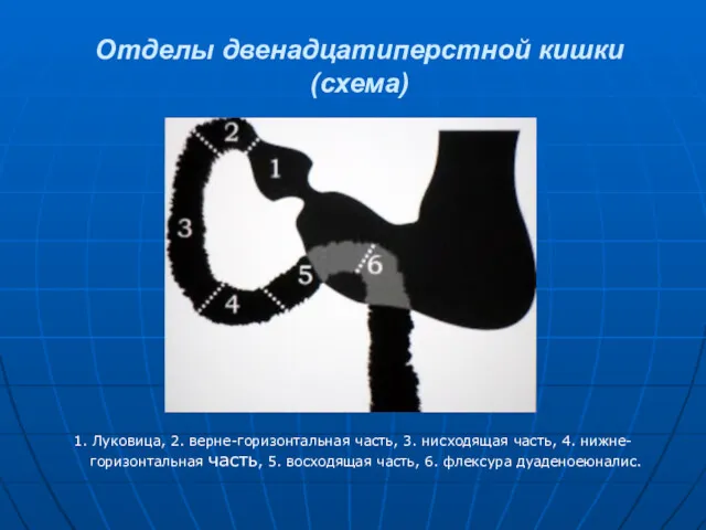 Отделы двенадцатиперстной кишки (схема) 1. Луковица, 2. верне-горизонтальная часть, 3.