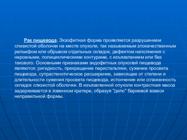 Рак пищевода. Экзофитная форма проявляется разрушением слизистой оболочки на месте