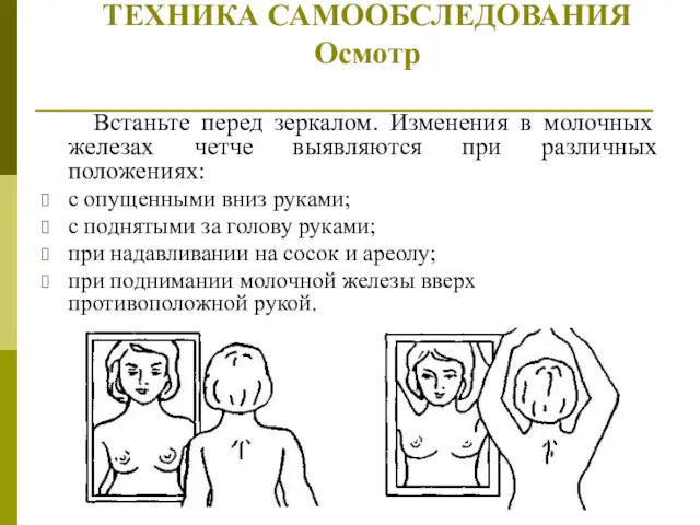 ТЕХНИКА САМООБСЛЕДОВАНИЯ Осмотр Встаньте перед зеркалом. Изменения в молочных железах