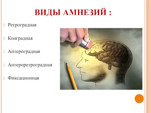 ВИДЫ АМНЕЗИЙ : Ретроградная Конградная Антероградная Антероретроградная Фиксационная