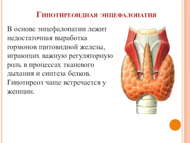 Гипотиреоидная энцефалопатия В основе энцефалопатии лежит недостаточная выработка гормонов щитовидной