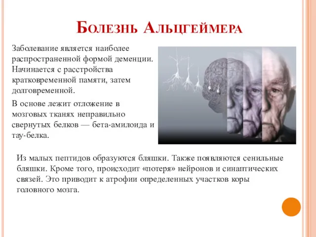 Болезнь Альцгеймера Заболевание является наиболее распространенной формой деменции. Начинается с