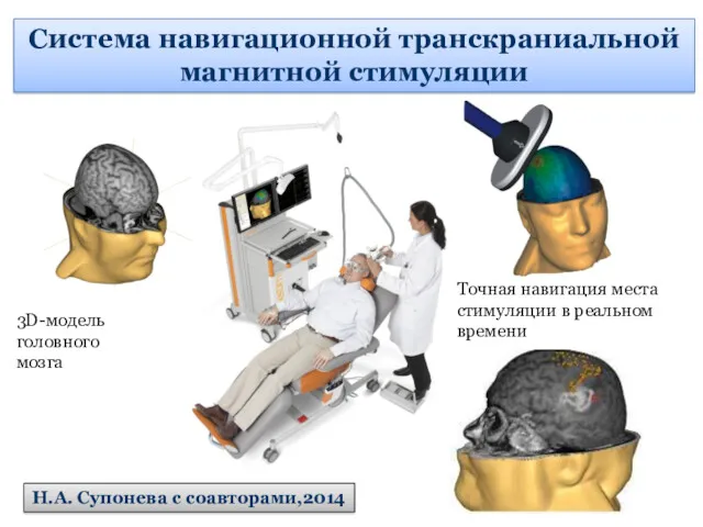 3D-модель головного мозга Точная навигация места стимуляции в реальном времени