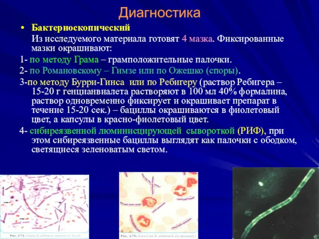 Диагностика Бактериоскопический Из исследуемого материала готовят 4 мазка. Фиксированные мазки