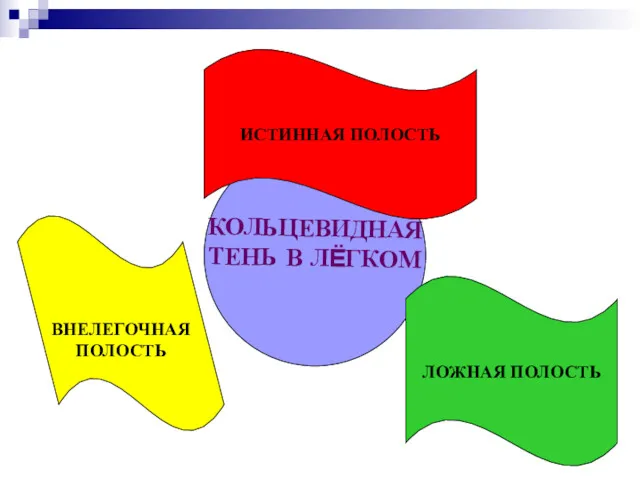 КОЛЬЦЕВИДНАЯ ТЕНЬ В ЛЁГКОМ ЛОЖНАЯ ПОЛОСТЬ ИСТИННАЯ ПОЛОСТЬ ВНЕЛЕГОЧНАЯ ПОЛОСТЬ