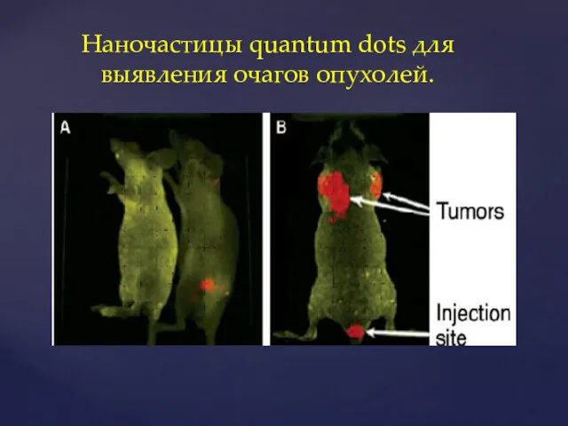 Наночастицы quantum dots для выявления очагов опухолей.