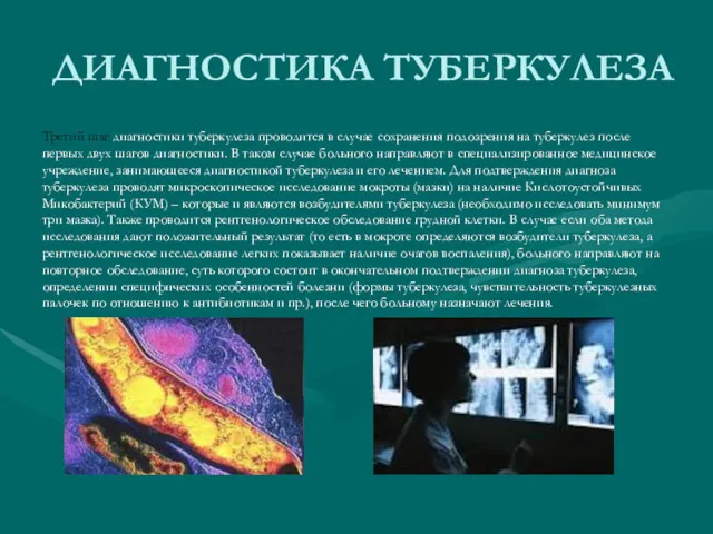 ДИАГНОСТИКА ТУБЕРКУЛЕЗА Третий шаг диагностики туберкулеза проводится в случае сохранения подозрения на туберкулез