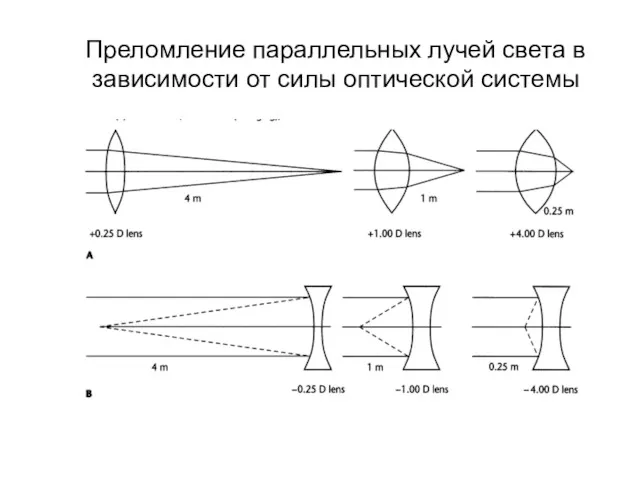 Преломление параллельных лучей света в зависимости от силы оптической системы