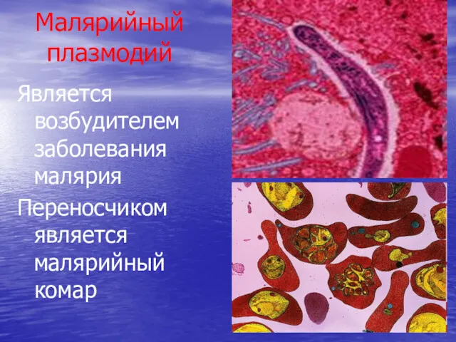 Малярийный плазмодий Является возбудителем заболевания малярия Переносчиком является малярийный комар