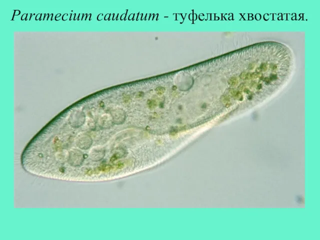Paramecium caudatum - туфелька хвостатая.