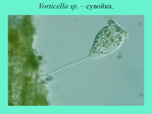 Vorticella sp. – сувойка.