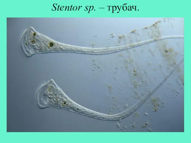 Stentor sp. – трубач.