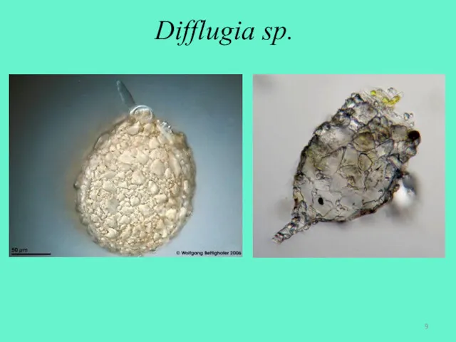 Difflugia sp.