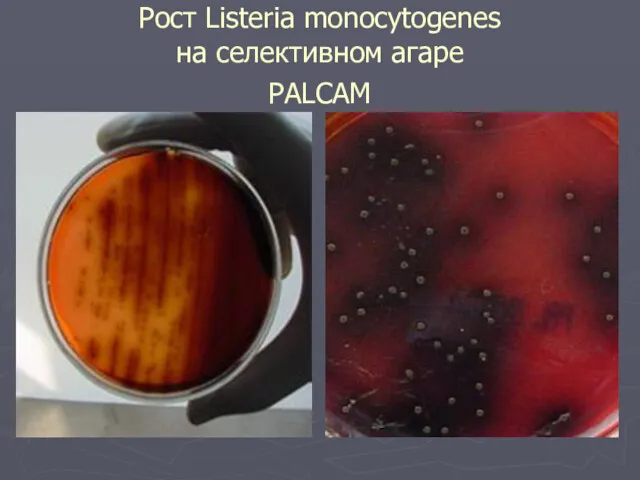 Рост Listeria monocytogenes на селективном агаре PALCAM