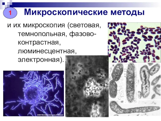 Микроскопические методы и их микроскопия (световая, темнопольная, фазово-контрастная, люминесцентная, электронная). 1