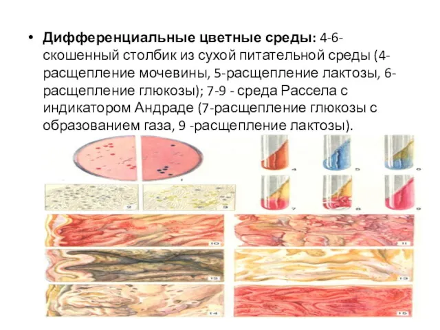 Дифференциальные цветные среды: 4-6-скошенный столбик из сухой питательной среды (4-расщепление мочевины, 5-расщепление лактозы,