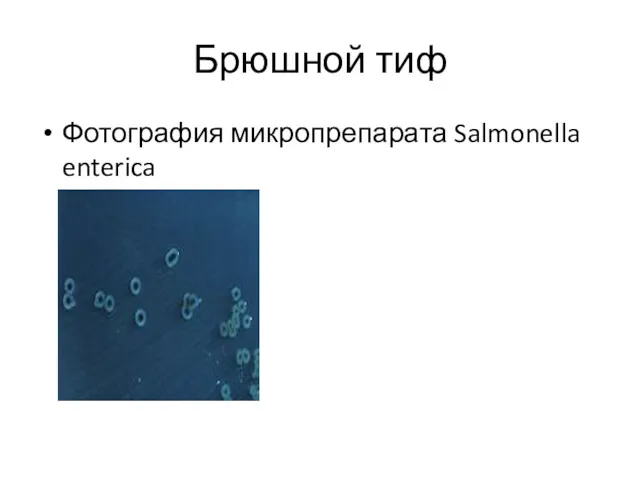 Брюшной тиф Фотография микропрепарата Salmonella enterica