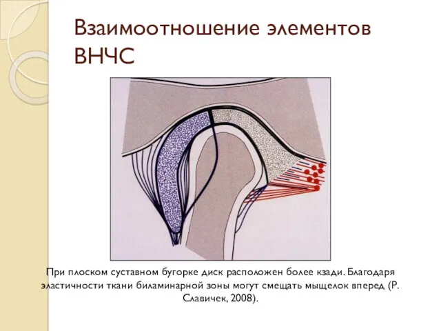 Взаимоотношение элементов ВНЧС При плоском суставном бугорке диск расположен более