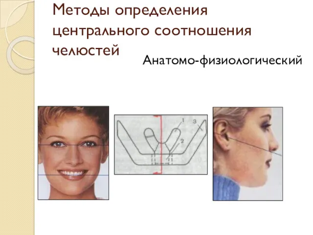 Методы определения центрального соотношения челюстей Анатомо-физиологический