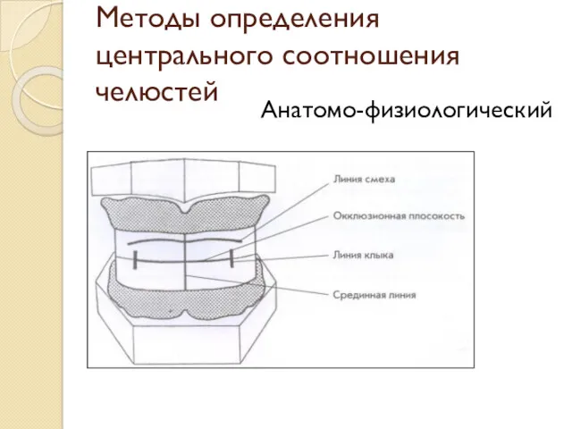 Методы определения центрального соотношения челюстей Анатомо-физиологический