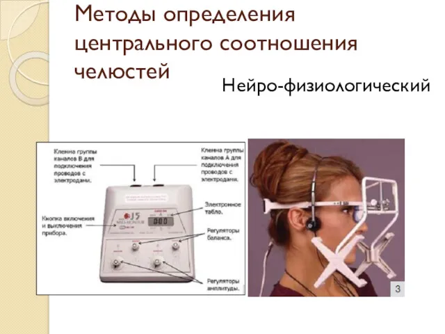 Методы определения центрального соотношения челюстей Нейро-физиологический