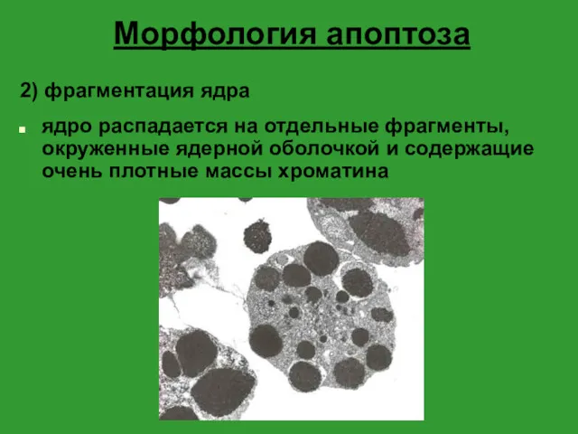 Морфология апоптоза 2) фрагментация ядра ядро распадается на отдельные фрагменты,