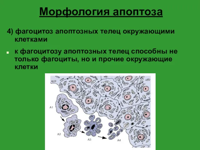Морфология апоптоза 4) фагоцитоз апоптозных телец окружающими клетками к фагоцитозу апоптозных телец способны