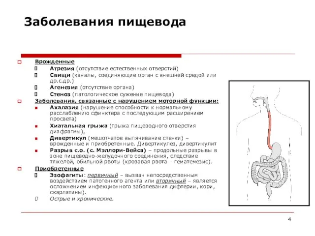 Заболевания пищевода Врожденные Атрезия (отсутствие естественных отверстий) Свищи (каналы, соединяющие