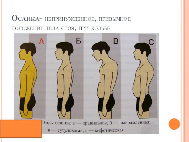 Осанка- непринуждённое, привычное положение тела стоя, при ходьбе