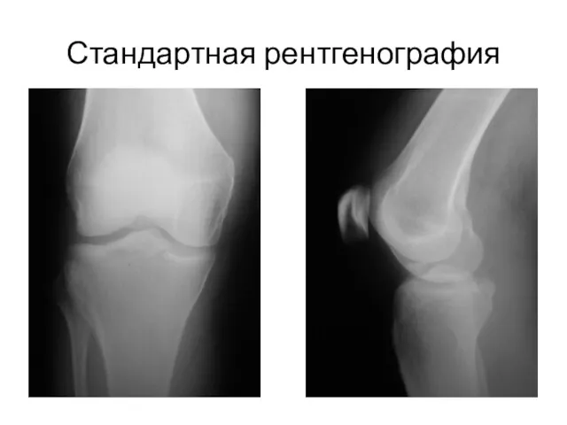 Стандартная рентгенография