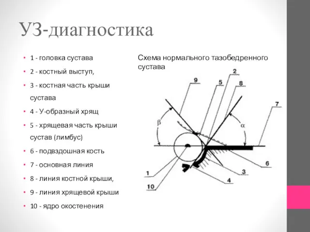 УЗ-диагностика 1 - головка сустава 2 - костный выступ, 3