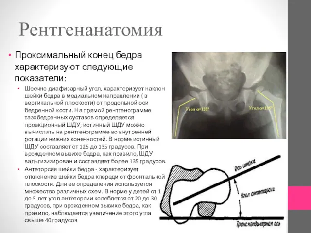 Рентгенанатомия Проксимальный конец бедра характеризуют следующие показатели: Шеечно-диафизарный угол, характеризует