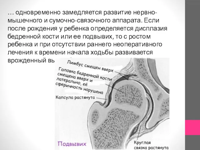 … одновременно замедляется развитие нервно-мышечного и сумочно-связочного аппарата. Если после