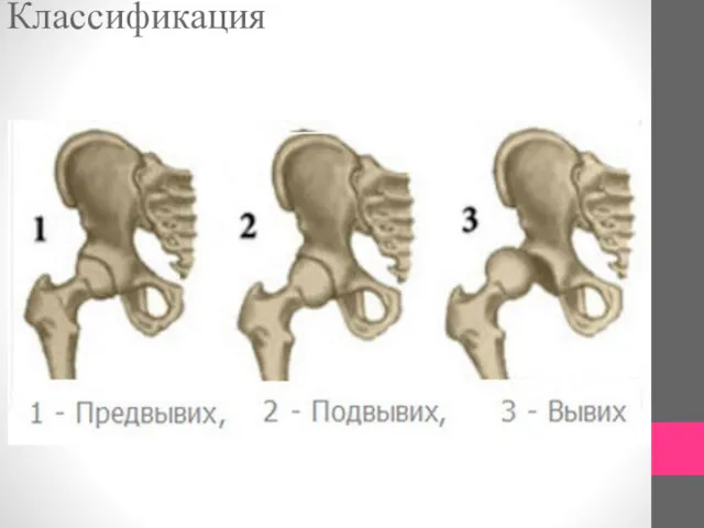 Классификация