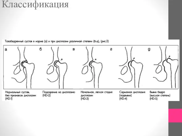 Классификация