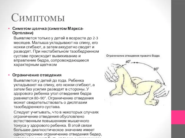 Симптомы Симптом щелчка (симптом Маркса-Ортолани) Выявляется только у детей в