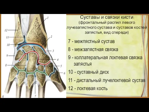 Суставы и связки кисти (фронтальный распил левого лучезапястного сустава и суставов костей запястья,