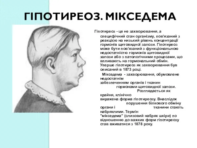 ГІПОТИРЕОЗ. МІКСЕДЕМА Гіпотиреоз - це не захворювання, а специфічний стан