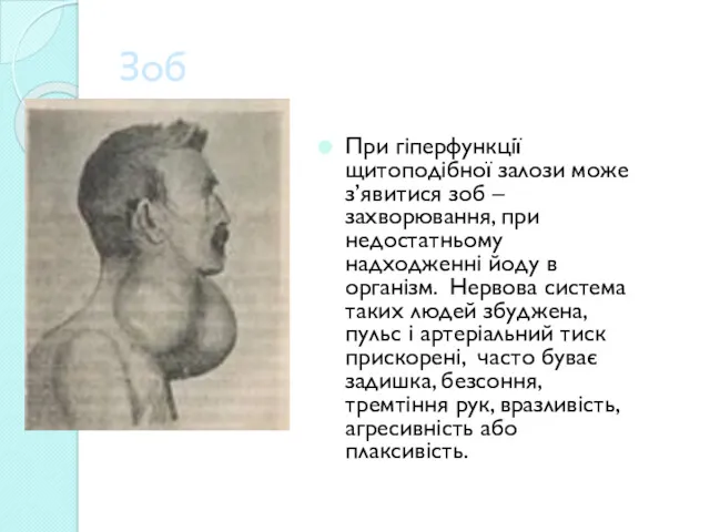 Зоб При гіперфункції щитоподібної залози може з’явитися зоб – захворювання,