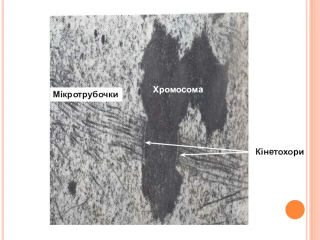 Хромосома Мікротрубочки Кінетохори