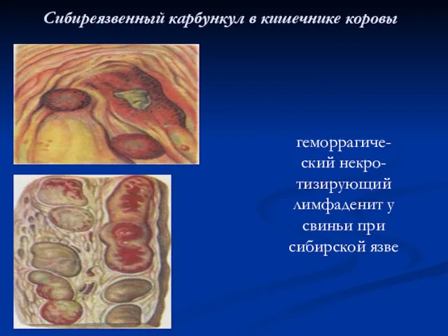 Сибиреязвенный карбункул в кишечнике коровы геморрагиче-ский некро-тизирующий лимфаденит у свиньи при сибирской язве