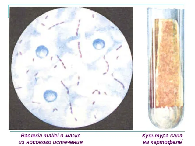 Bacteria mallei в мазке из носового истечения Культура сапа на картофеле