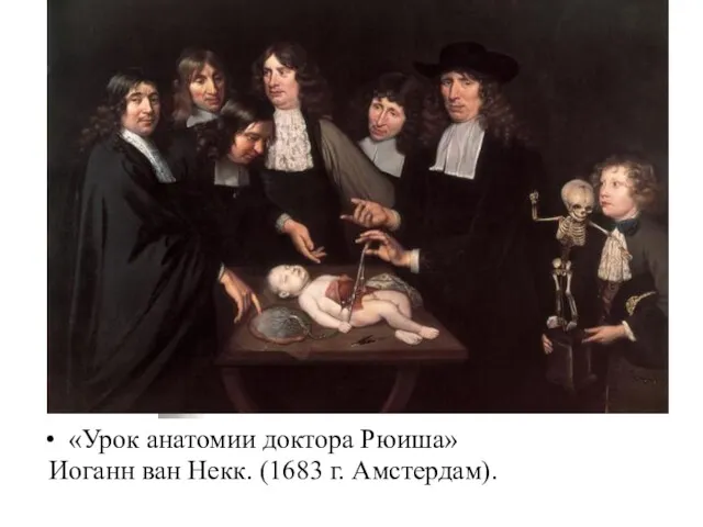 «Урок анатомии доктора Рюиша» Иоганн ван Некк. (1683 г. Амстердам).