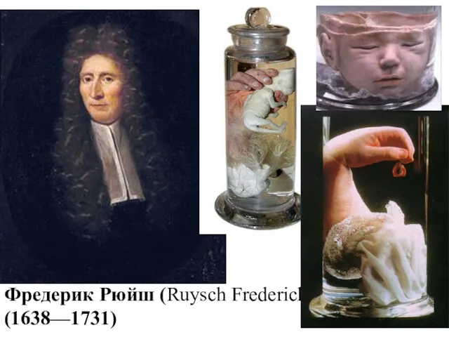 Фредерик Рюйш (Ruysch Frederick) (1638—1731)