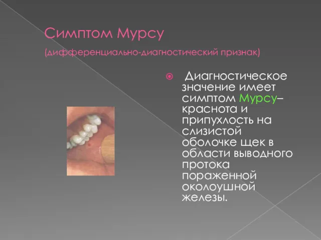 Симптом Мурсу (дифференциально-диагностический признак) Диагностическое значение имеет симптом Мурсу– краснота