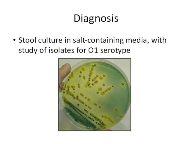 Diagnosis Stool culture in salt-containing media, with study of isolates for O1 serotype