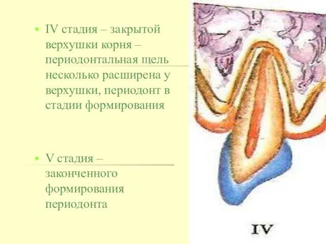 IV стадия – закрытой верхушки корня – периодонтальная щель несколько