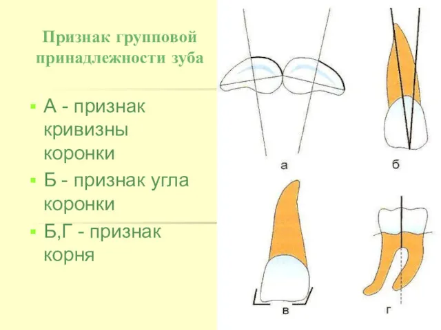 Признак групповой принадлежности зуба А - признак кривизны коронки Б