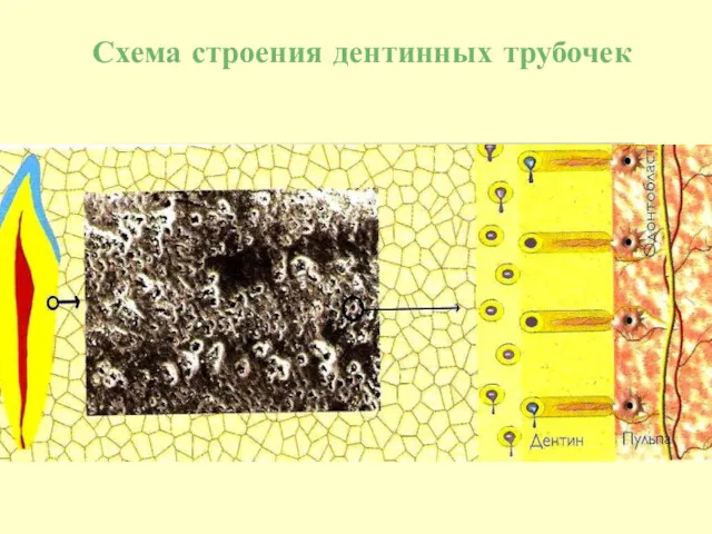 Схема строения дентинных трубочек