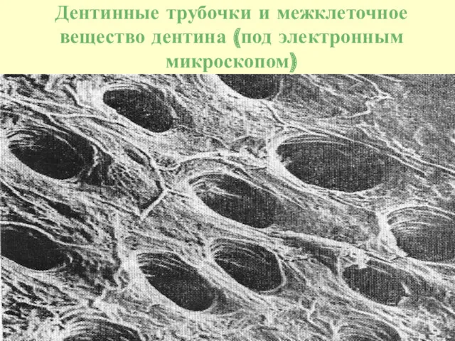Дентинные трубочки и межклеточное вещество дентина (под электронным микроскопом)